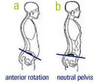 anterior-pelvic-tilt.png