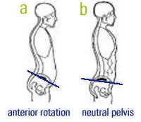anterior-pelvic-tilt
