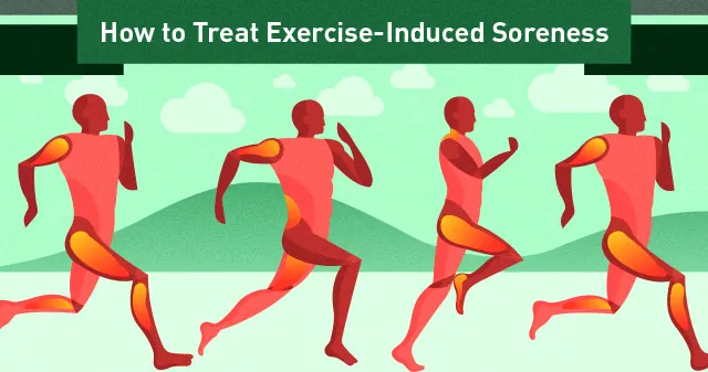 Picture of How To Treat Exercise Induced Muscle Soreness