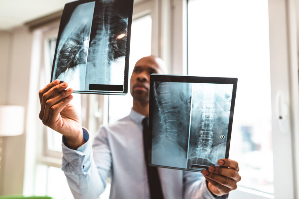 Lumbar Spinal Stenosis Symptoms & Causes - PMIR Medical Center