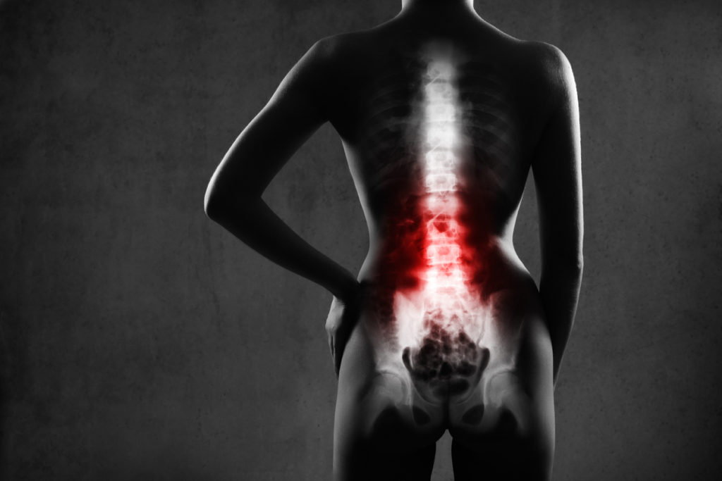 How to Diagnose Failed Back Surgery Syndrome - PMIR