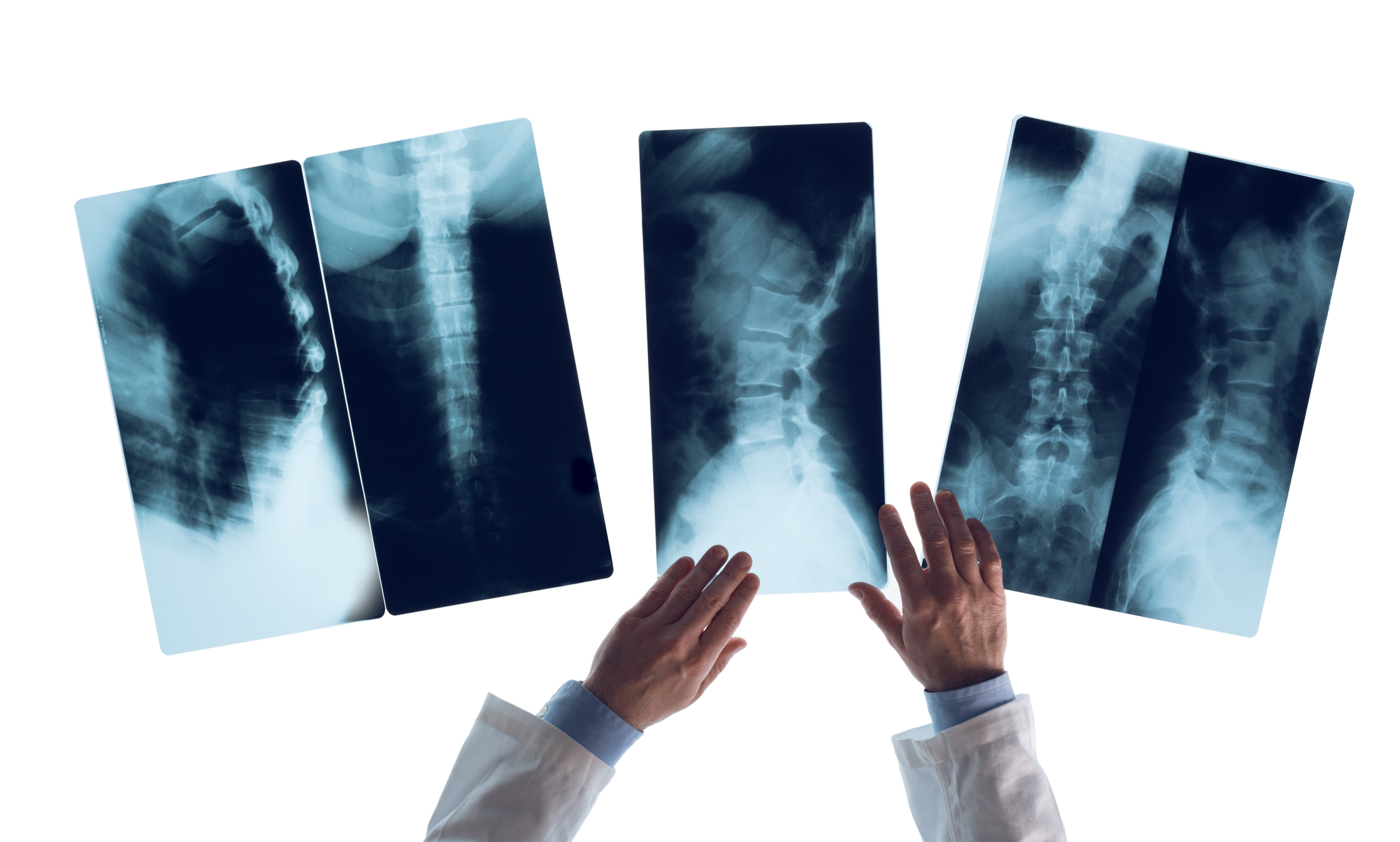 Which Spine Specialist Should You See for Your Specific Issue? - Pain Management & Injury Relief