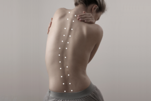 How Long Does Sciatica Last? - PMIR Medical Center