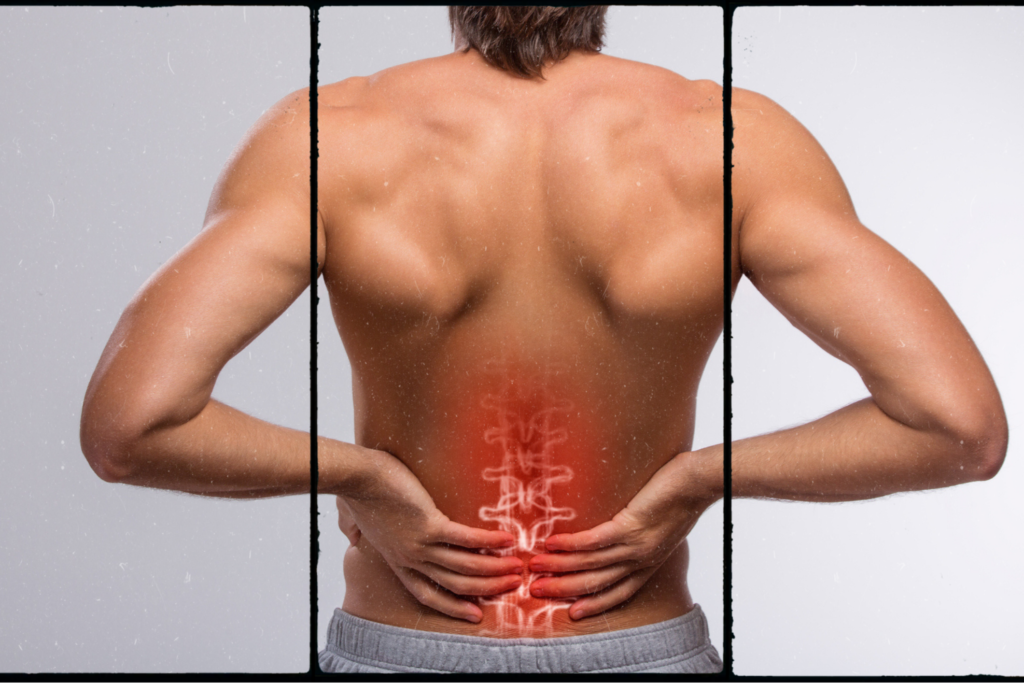 Triggers For Sciatica Nerve Pain