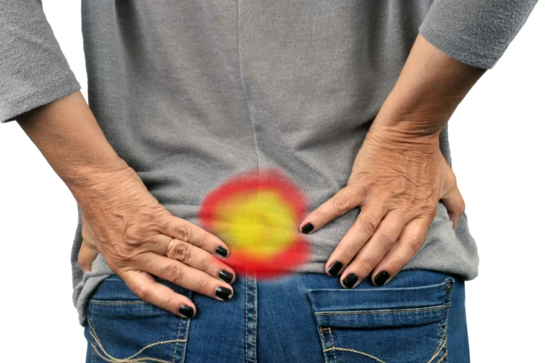 Is Sciatica Causing My Buttock Pain? - PMIR