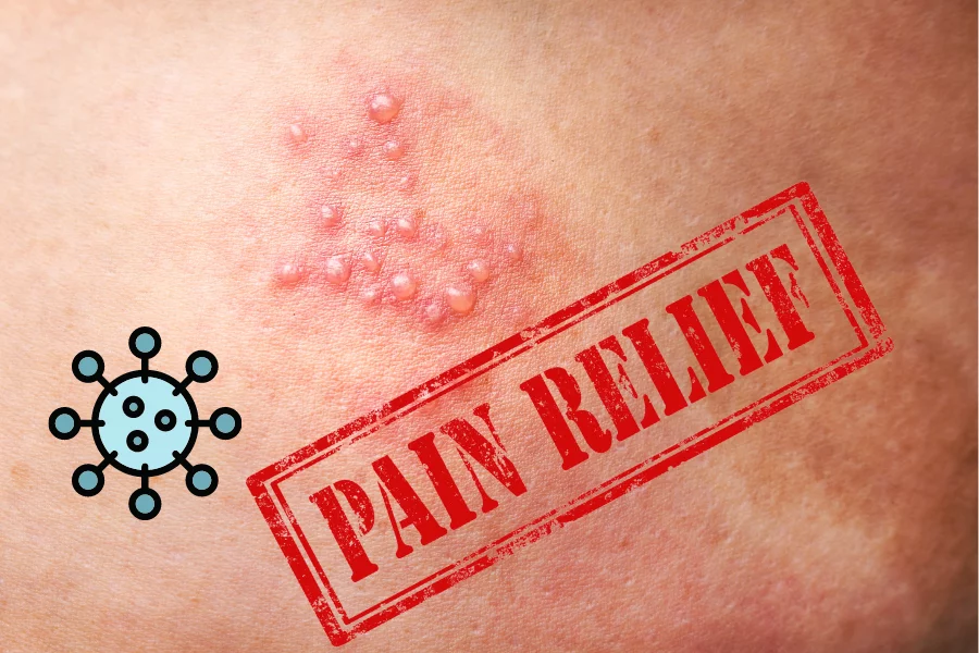 Shingles Pain Relief 