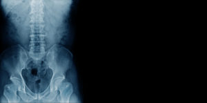 Cervical, Thoracic and Lumbar Facet Joint Injections - PMIR