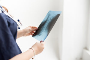 Everything You Need to Know About the Superion Vertiflex Procedure - PMIR