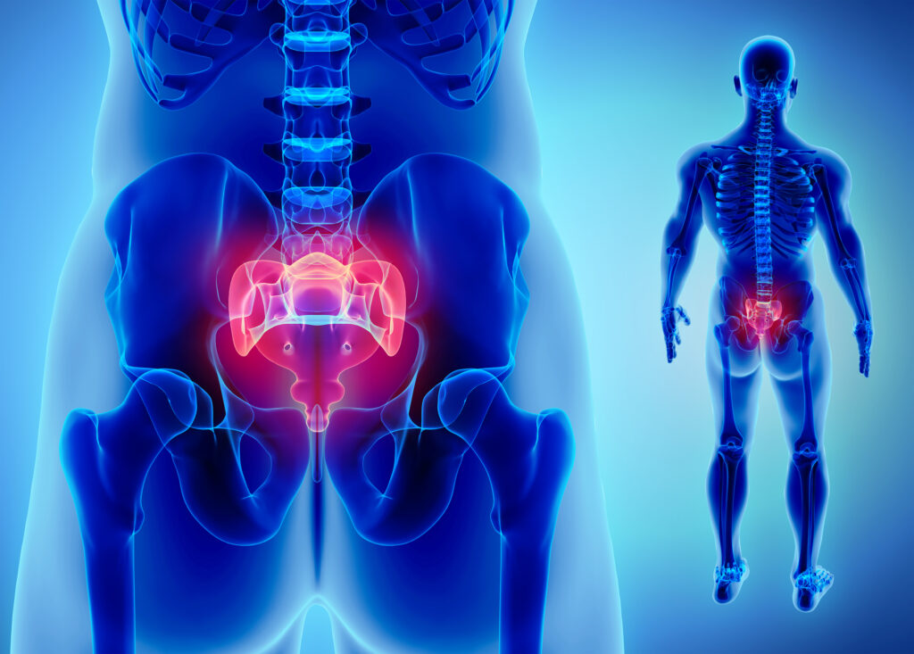 Tailbone Pain Causes, Symptoms, and Treatment - PMIR