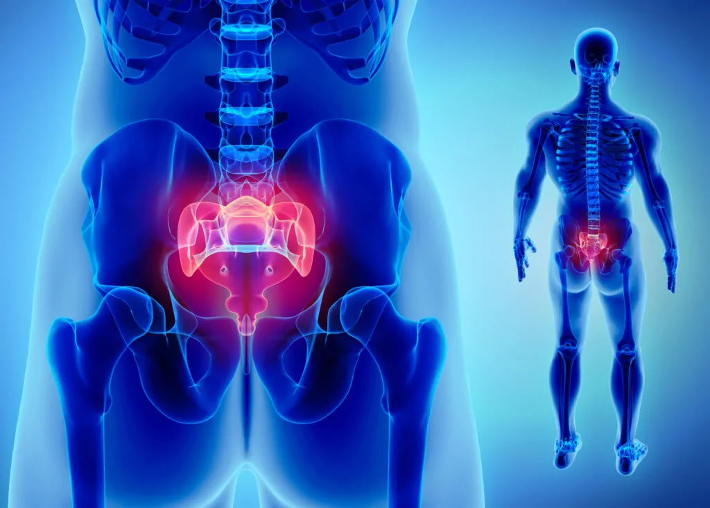 Tailbone Pain Causes, Symptoms, and Treatment - PMIR