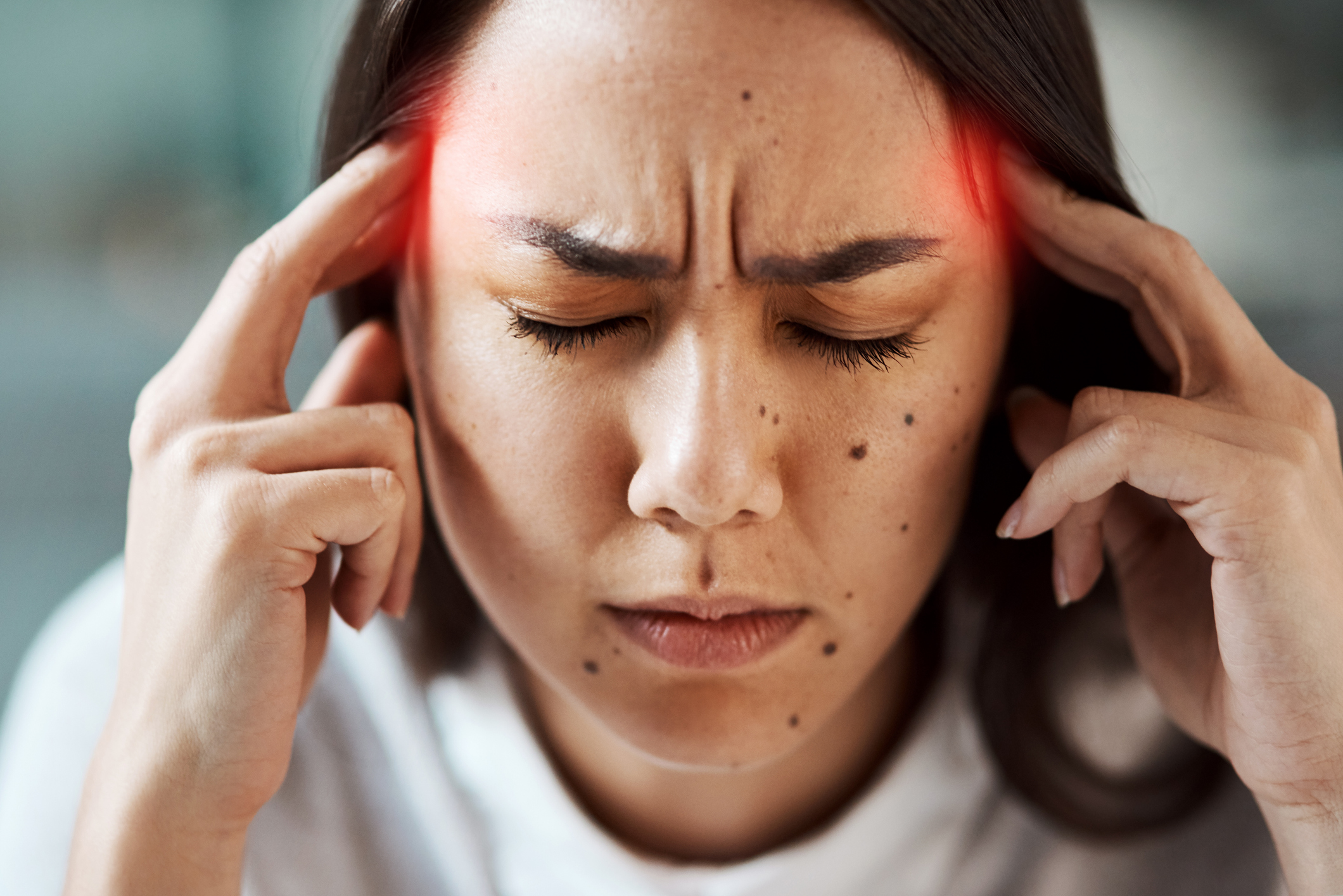 What Is New Daily Persistent Headache PMIR