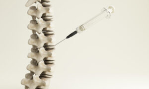 What to Do When Epidural Injections Don’t Work - PMIR